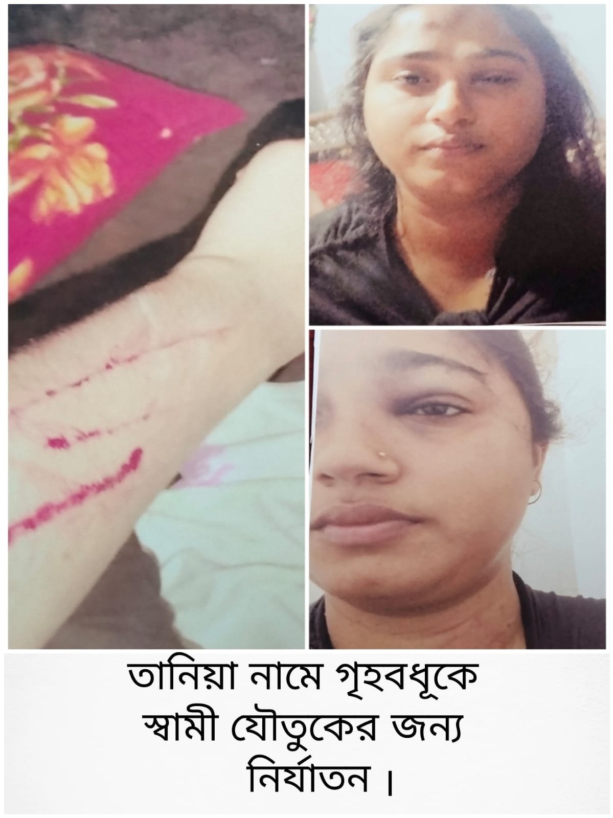 নগরীর  দক্ষিণ কাজলশাহ নবাব রোড যৌতুক না পেয়ে স্ত্রীকে কুপিয়ে জখম